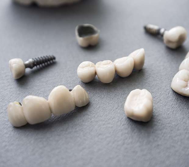 Richmond The Difference Between Dental Implants and Mini Dental Implants